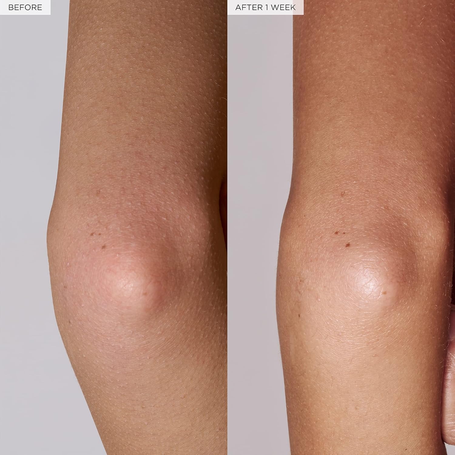 Glow Recipe Watermelon Glow Pink Dream Body Cream - Hyaluronic Acid for Skin Barrier Repair - Non Greasy Body Cream Brightening Moisturizer with Watermelon Seed Butter + AHA's (200ml)