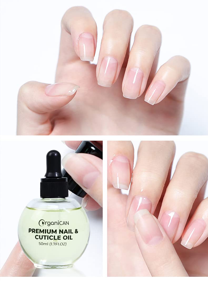 Premium Nail & Cuticle Oil – Almond & Vitamin E Hydrating Serum with Milk & Honey Formula | Nourishes Dry Cuticles & Supports Healthy Nails (50ml / 1.7 fl oz)